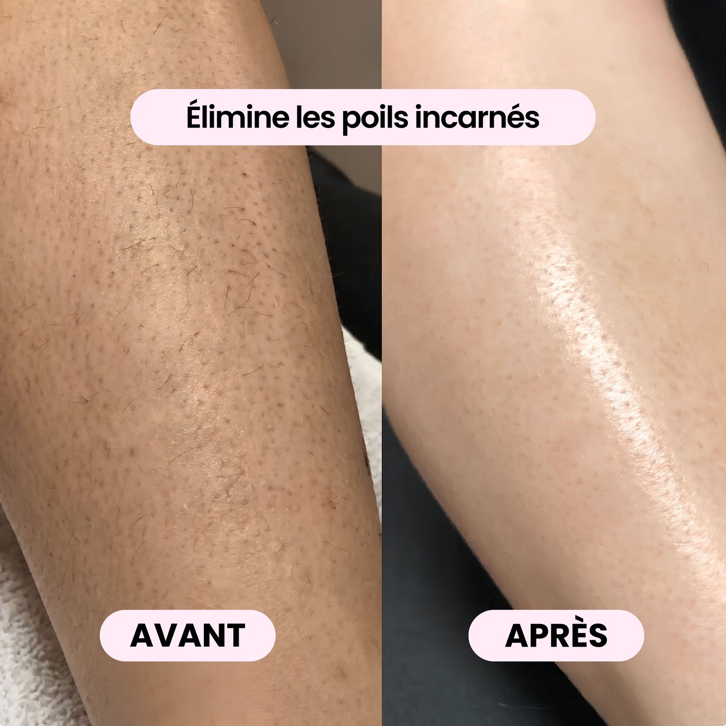 Rasoir 2-en-1 corps & bikini - BODYKLYNE