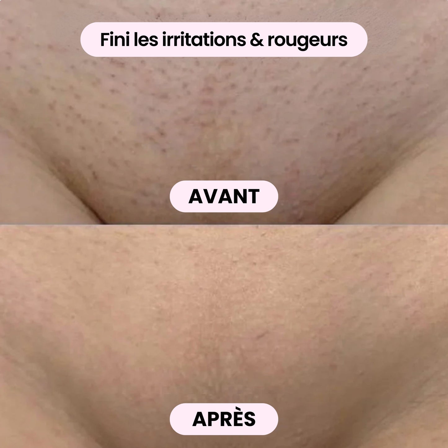 Rasoir 2-en-1 corps & bikini - BODYKLYNE