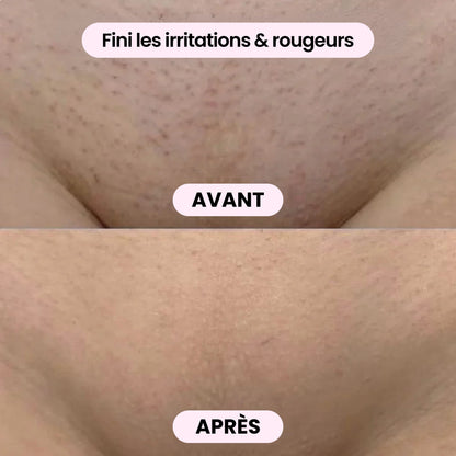 Rasoir 2-en-1 corps & bikini - BODYKLYNE